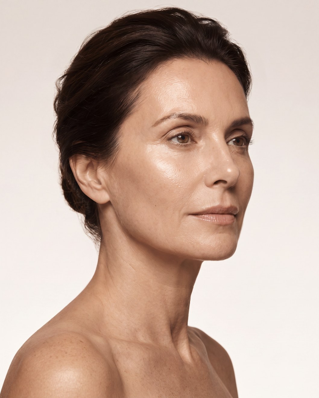 Sculptra — Collo